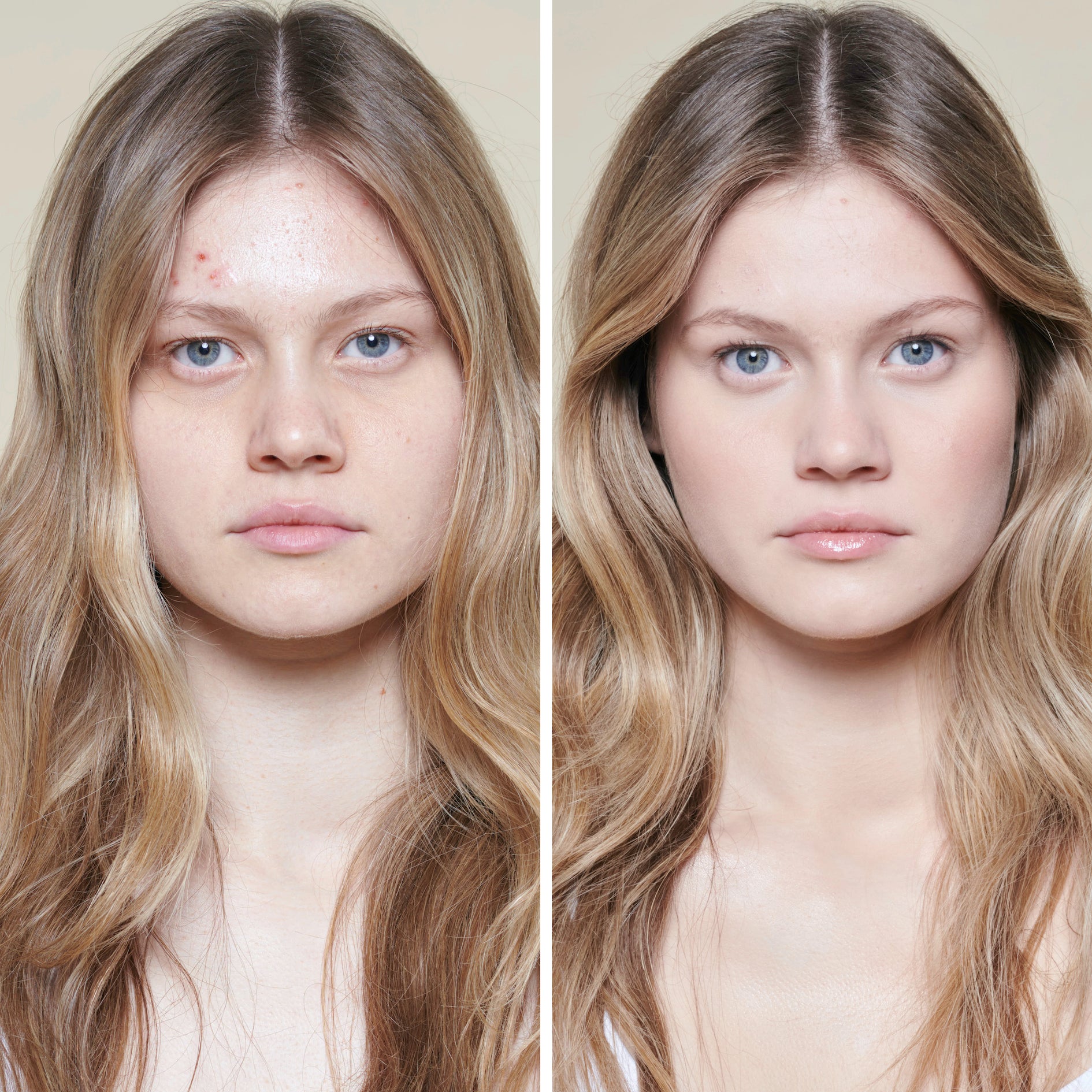 ALLEVEN foundation set - Opal (very light)